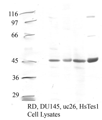 Cathepsin-F